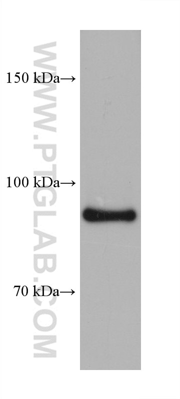 ATP1A1/2