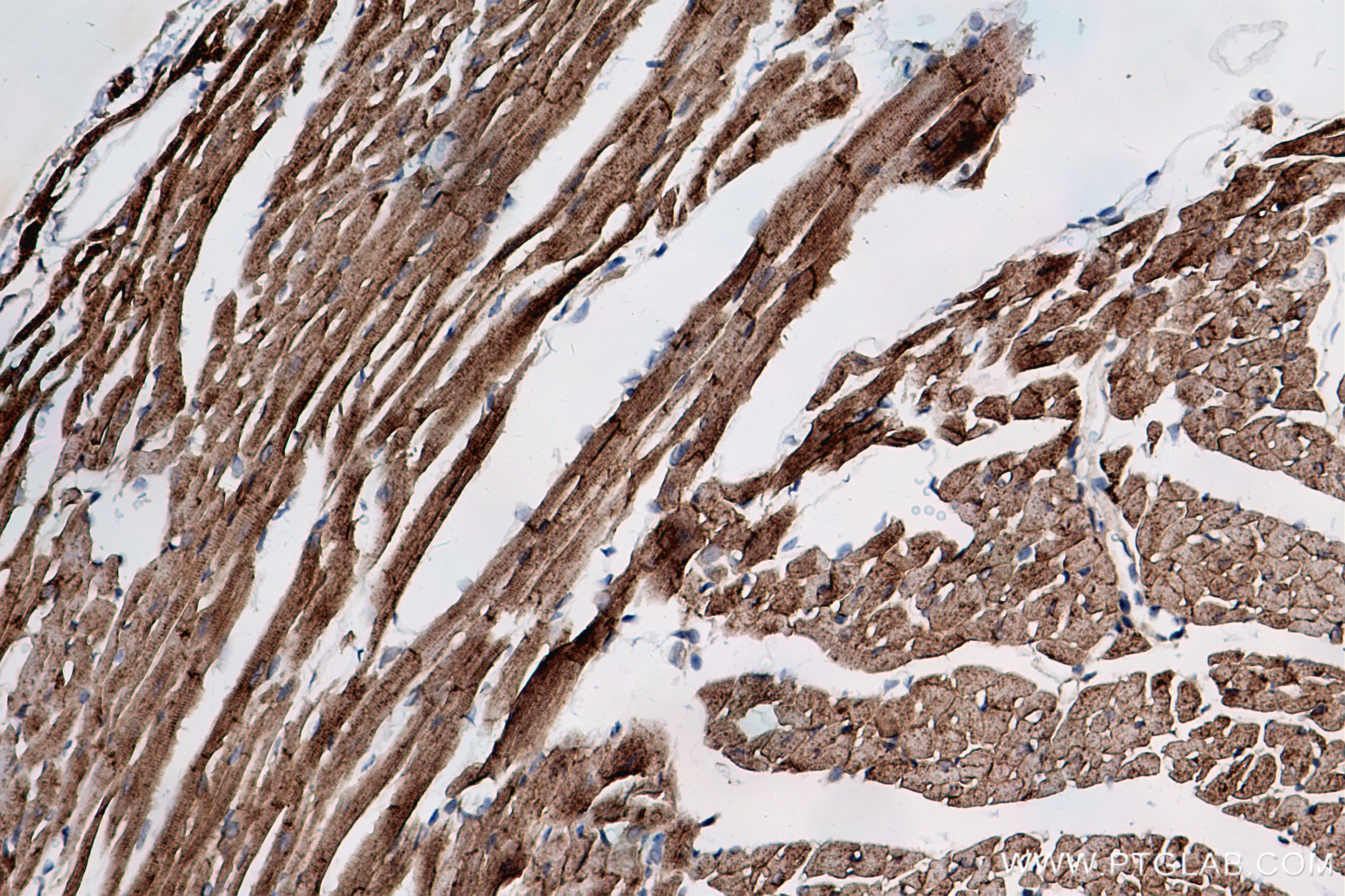 Immunohistochemistry (IHC) staining of mouse heart tissue using ATP1A2 Recombinant antibody (84999-4-RR)