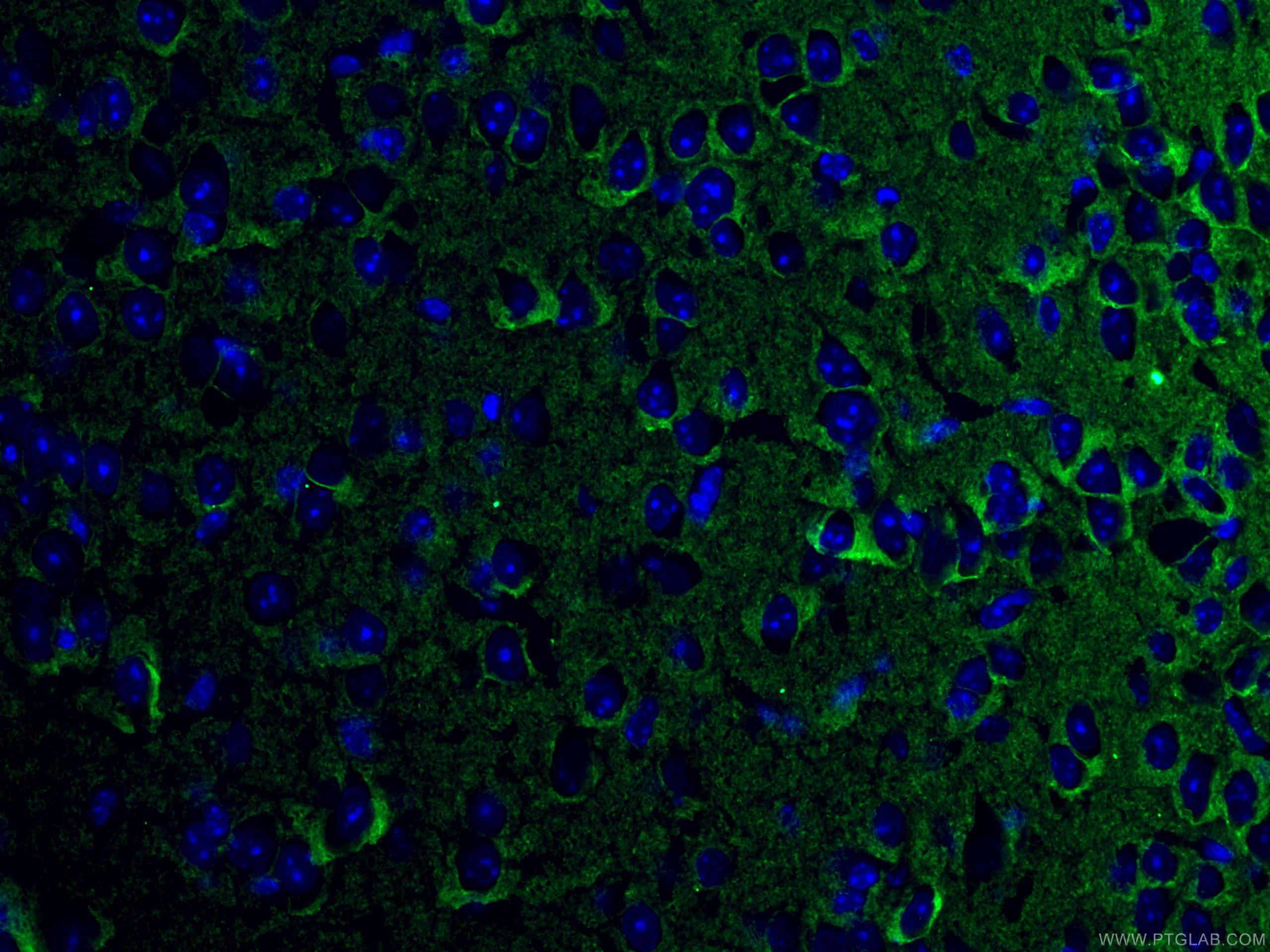 IF Staining of mouse brain using 10868-1-AP