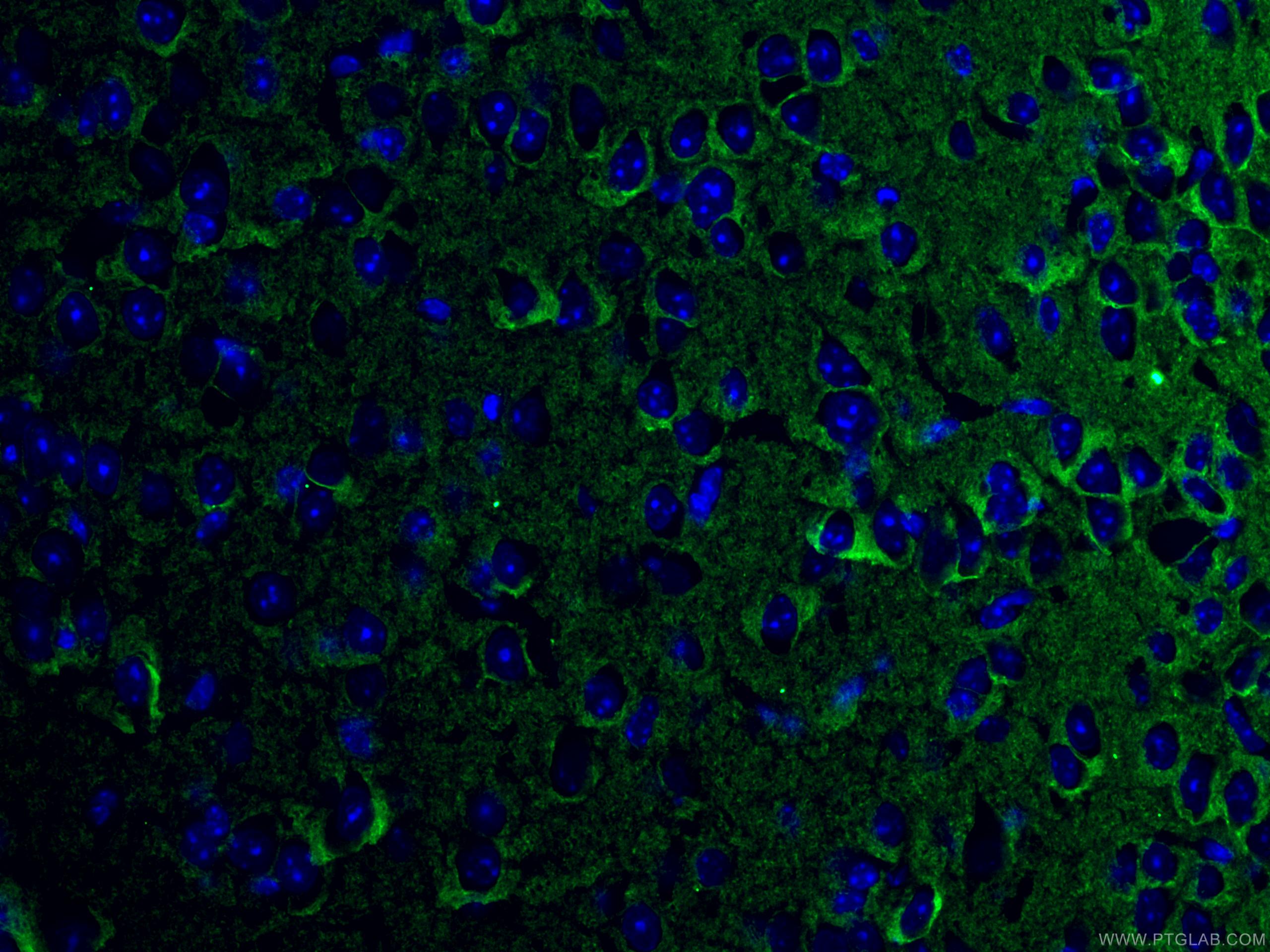 Immunofluorescence (IF) / fluorescent staining of mouse brain tissue using ATP1A3 (C-terminal) Polyclonal antibody (10868-1-AP)