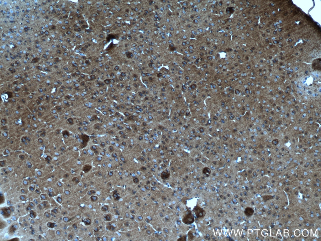 Immunohistochemistry (IHC) staining of mouse brain tissue using ATP1A3 (C-terminal) Polyclonal antibody (10868-1-AP)