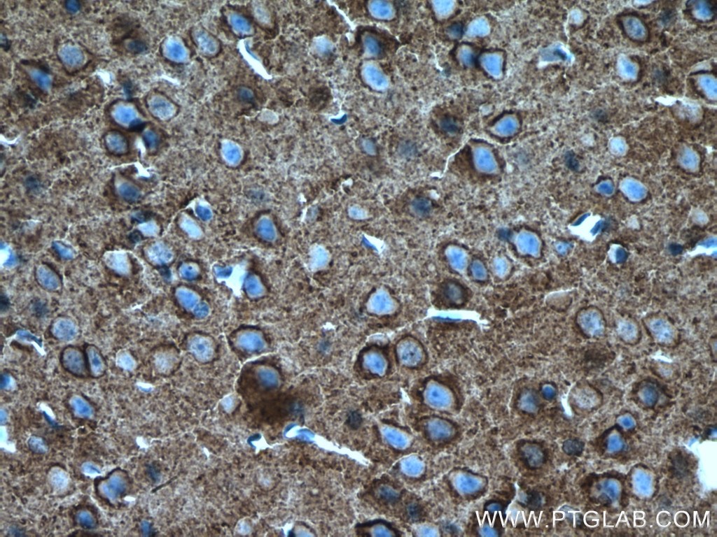 Immunohistochemistry (IHC) staining of mouse brain tissue using ATP1A3 (C-terminal) Polyclonal antibody (10868-1-AP)
