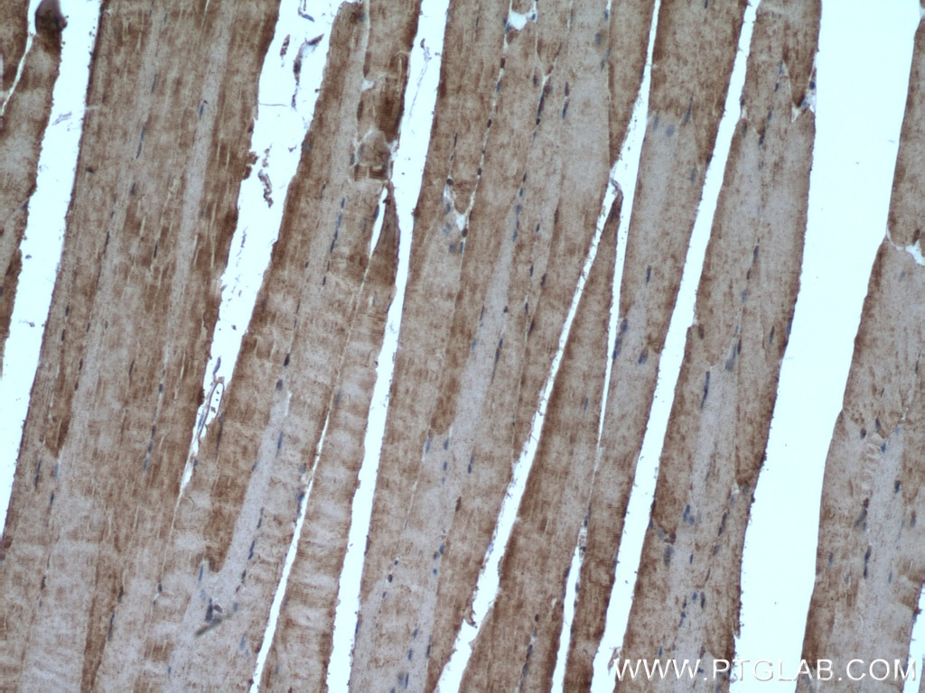 Immunohistochemistry (IHC) staining of mouse skeletal muscle tissue using ATP1A3 (C-terminal) Polyclonal antibody (10868-1-AP)