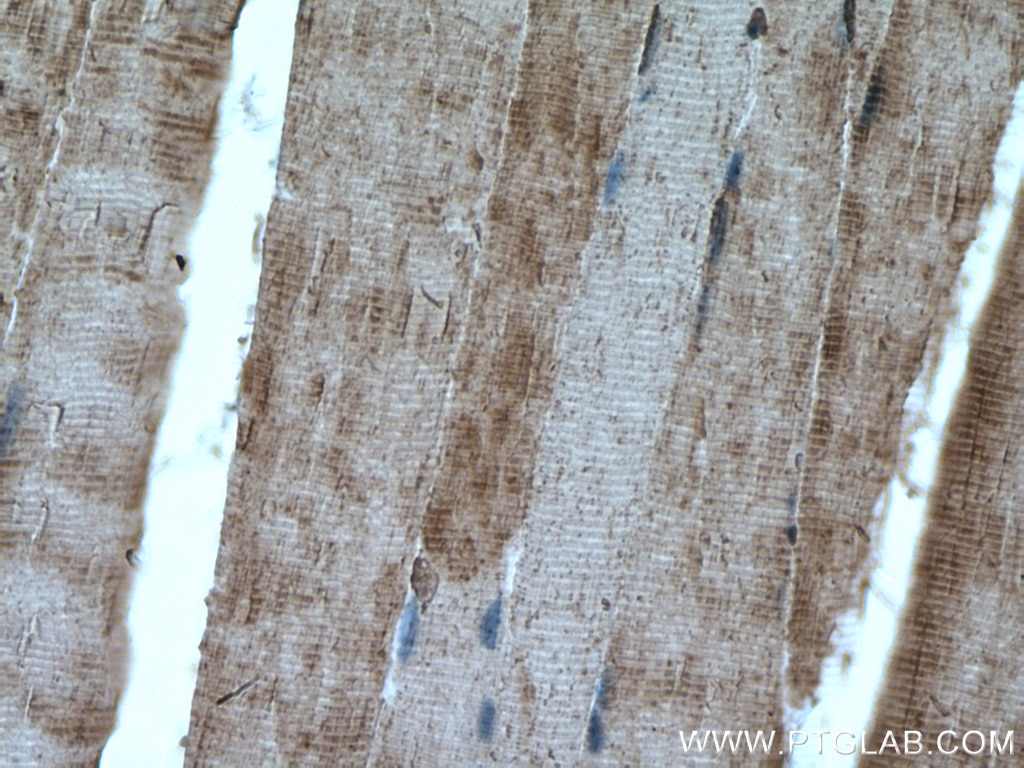 Immunohistochemistry (IHC) staining of mouse skeletal muscle tissue using ATP1A3 (C-terminal) Polyclonal antibody (10868-1-AP)