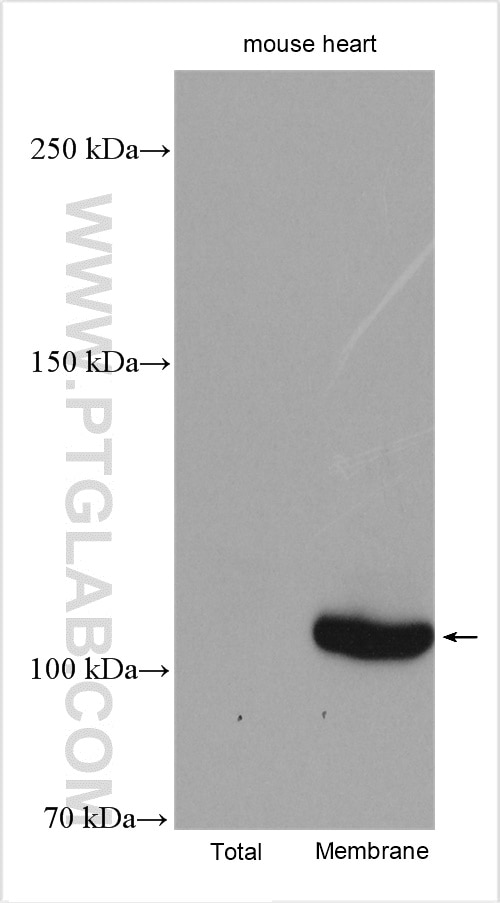 Western Blot (WB) analysis of various lysates using ATP1A3 (C-terminal) Polyclonal antibody (10868-1-AP)