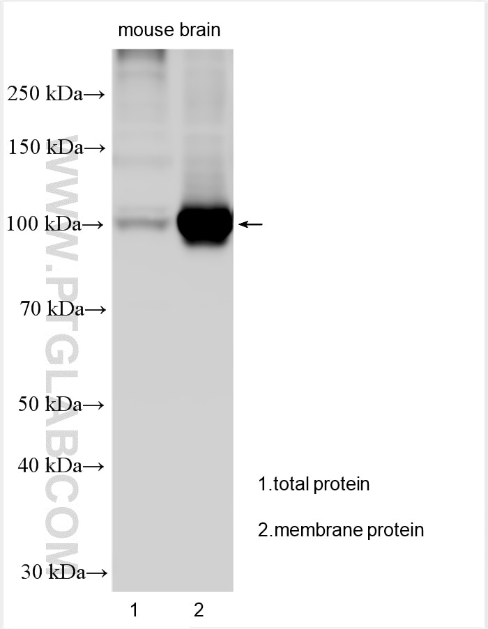 Western Blot (WB) analysis of various lysates using ATP1A3 (C-terminal) Polyclonal antibody (10868-1-AP)