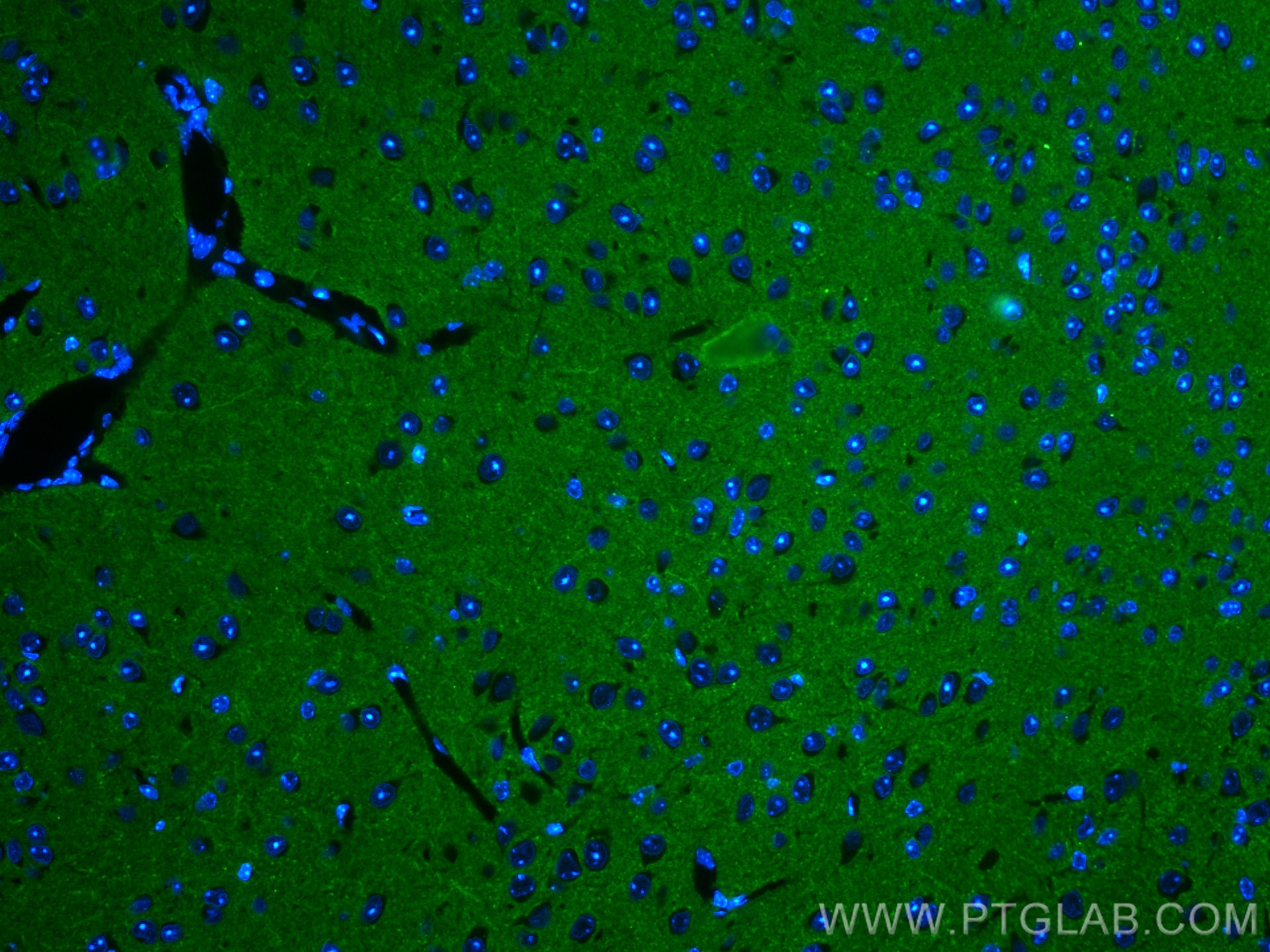 Immunofluorescence (IF) / fluorescent staining of mouse brain tissue using ATP1A3 Polyclonal antibody (25727-1-AP)