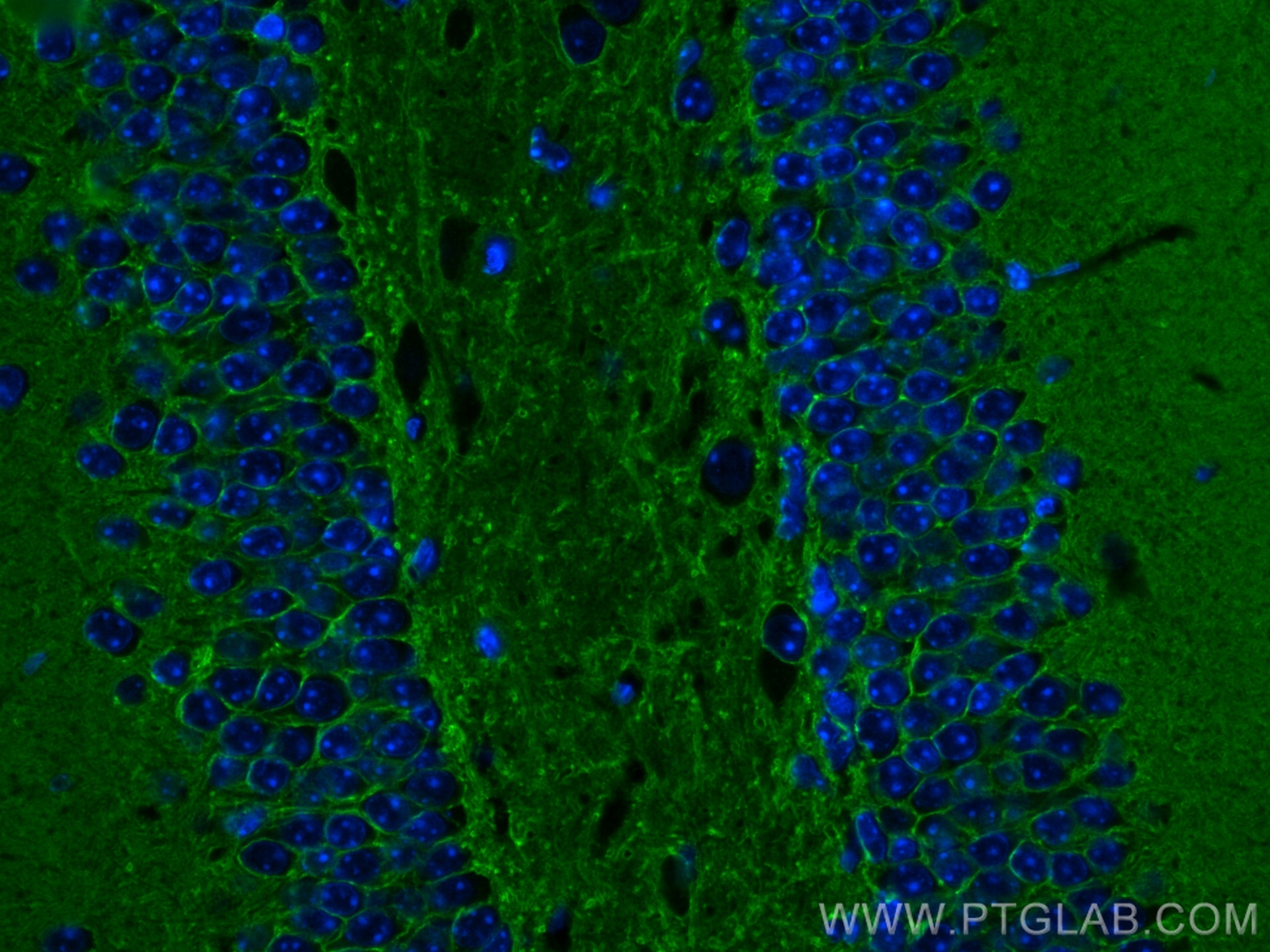 Immunofluorescence (IF) / fluorescent staining of mouse brain tissue using ATP1A3 Polyclonal antibody (25727-1-AP)