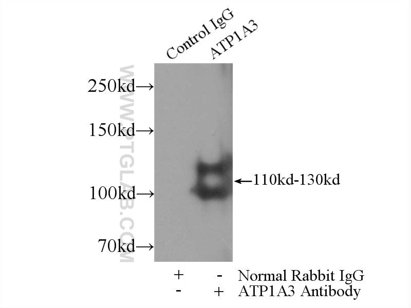 ATP1A3