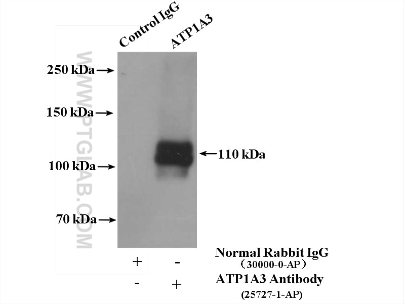 Immunoprecipitation (IP) experiment of rat brain tissue using ATP1A3 Polyclonal antibody (25727-1-AP)