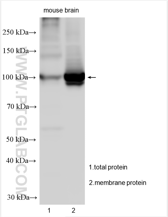 Western Blot (WB) analysis of various lysates using ATP1A3 Polyclonal antibody (25727-1-AP)