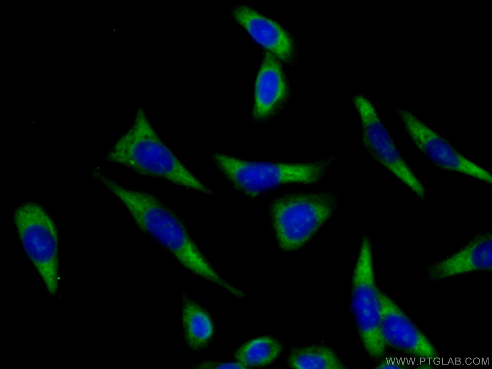 Immunofluorescence (IF) / fluorescent staining of HeLa cells using ATP1A3 (middle) Polyclonal antibody (28030-1-AP)