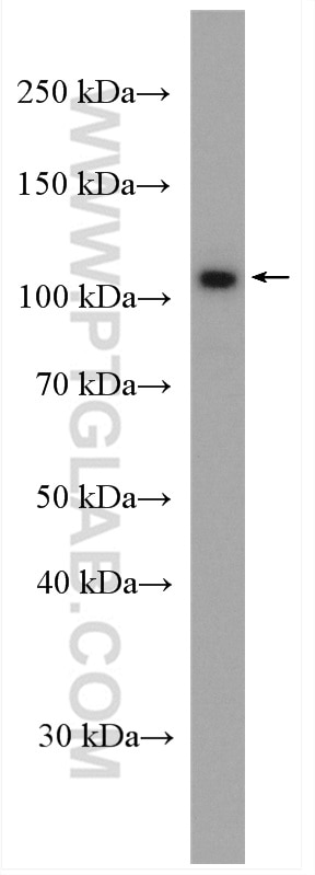 Western Blot (WB) analysis of HeLa cells using ATP1A3 (middle) Polyclonal antibody (28030-1-AP)
