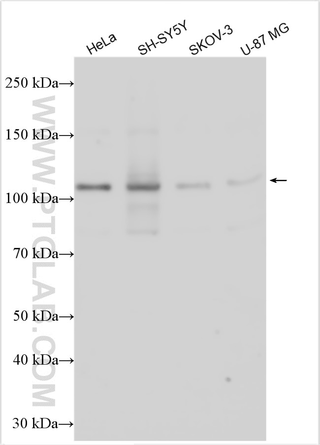 Western Blot (WB) analysis of various lysates using ATP1A3 (middle) Polyclonal antibody (28030-1-AP)