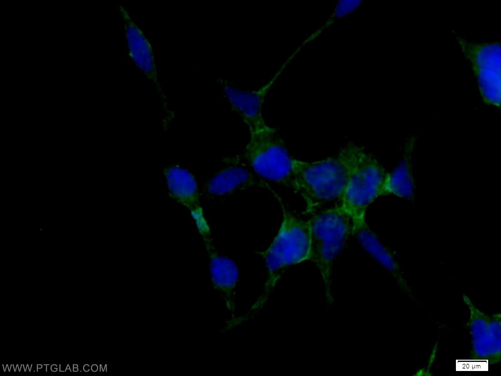 Immunofluorescence (IF) / fluorescent staining of HEK-293 cells using ATP1B1 Polyclonal antibody (15192-1-AP)