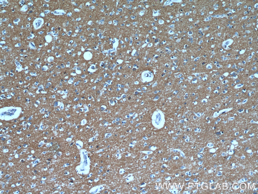 Immunohistochemistry (IHC) staining of human brain tissue using ATP1B1 Polyclonal antibody (15192-1-AP)