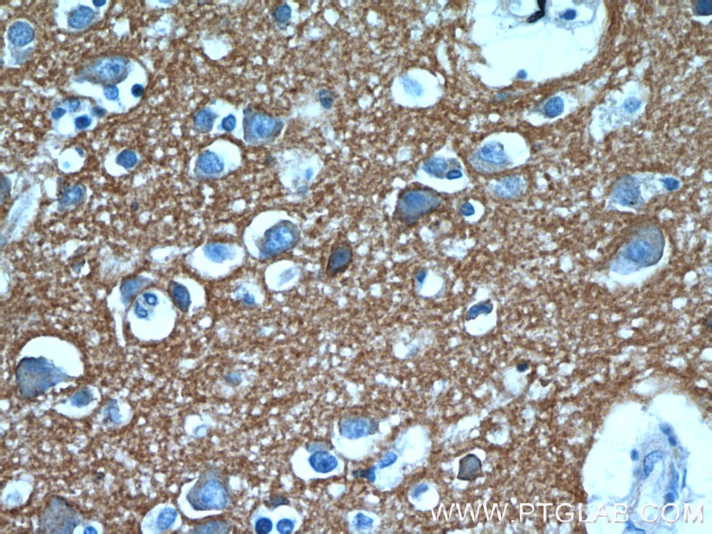 Immunohistochemistry (IHC) staining of human brain tissue using ATP1B1 Polyclonal antibody (15192-1-AP)