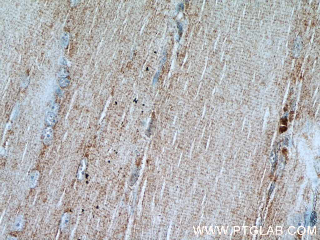 IHC staining of human skeletal muscle using 15192-1-AP