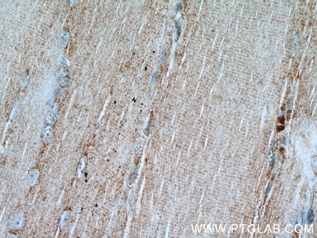 Immunohistochemistry (IHC) staining of human skeletal muscle tissue using ATP1B1 Polyclonal antibody (15192-1-AP)