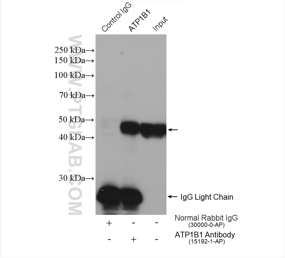 Immunoprecipitation (IP) experiment of mouse brain tissue using ATP1B1 Polyclonal antibody (15192-1-AP)