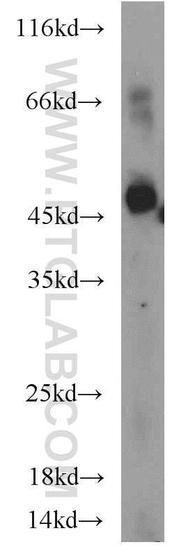 Western Blot (WB) analysis of human brain tissue using ATP1B1 Polyclonal antibody (15192-1-AP)