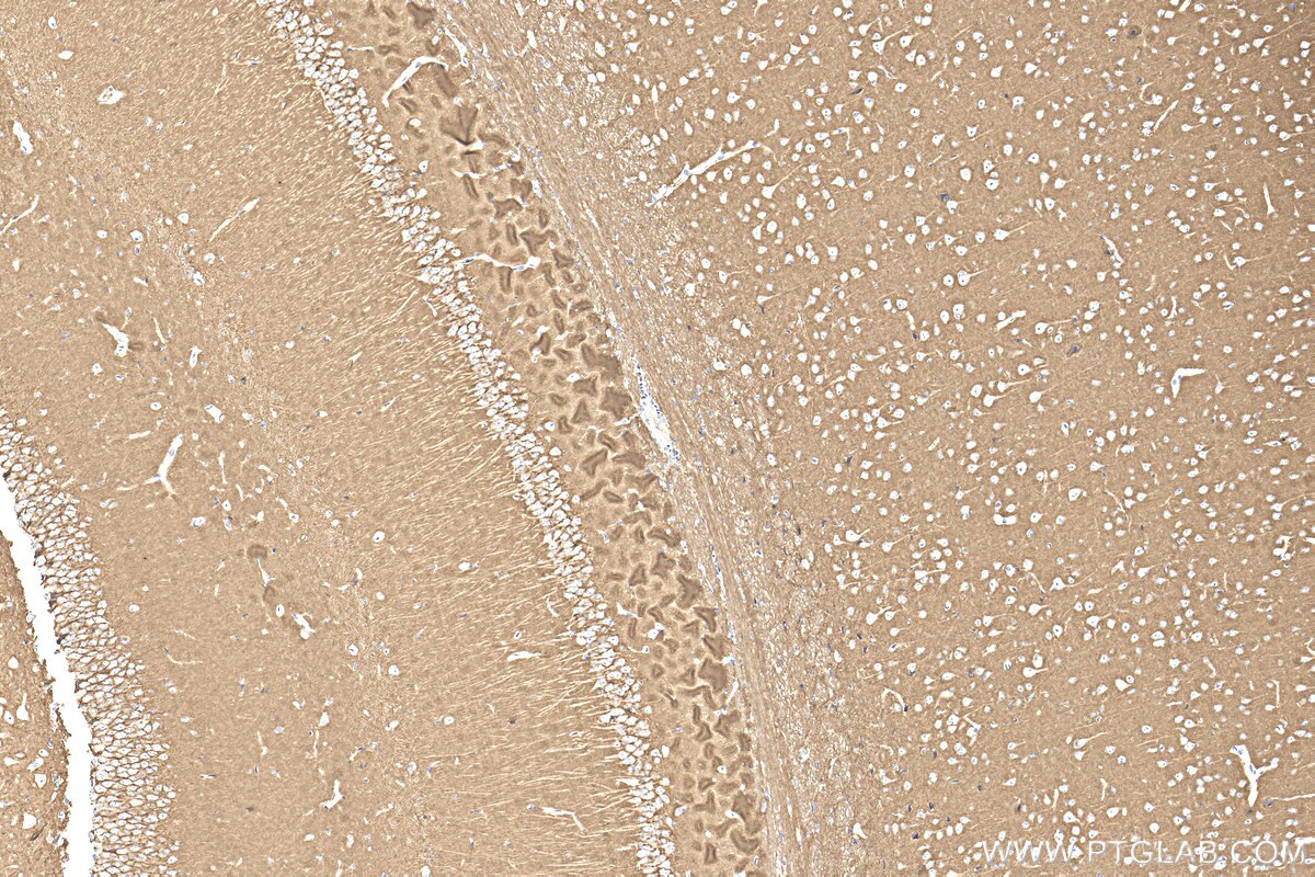 IHC staining of mouse brain using 32764-1-AP Immunohistochemistry (IHC) staining of mouse brain tissue using ATP1B1 Polyclonal antibody (32764-1-AP)