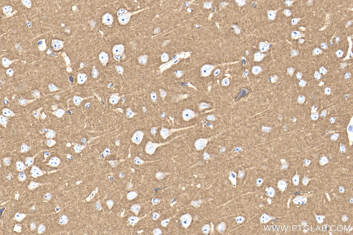 IHC staining of mouse brain using 32764-1-AP Immunohistochemistry (IHC) staining of mouse brain tissue using ATP1B1 Polyclonal antibody (32764-1-AP)