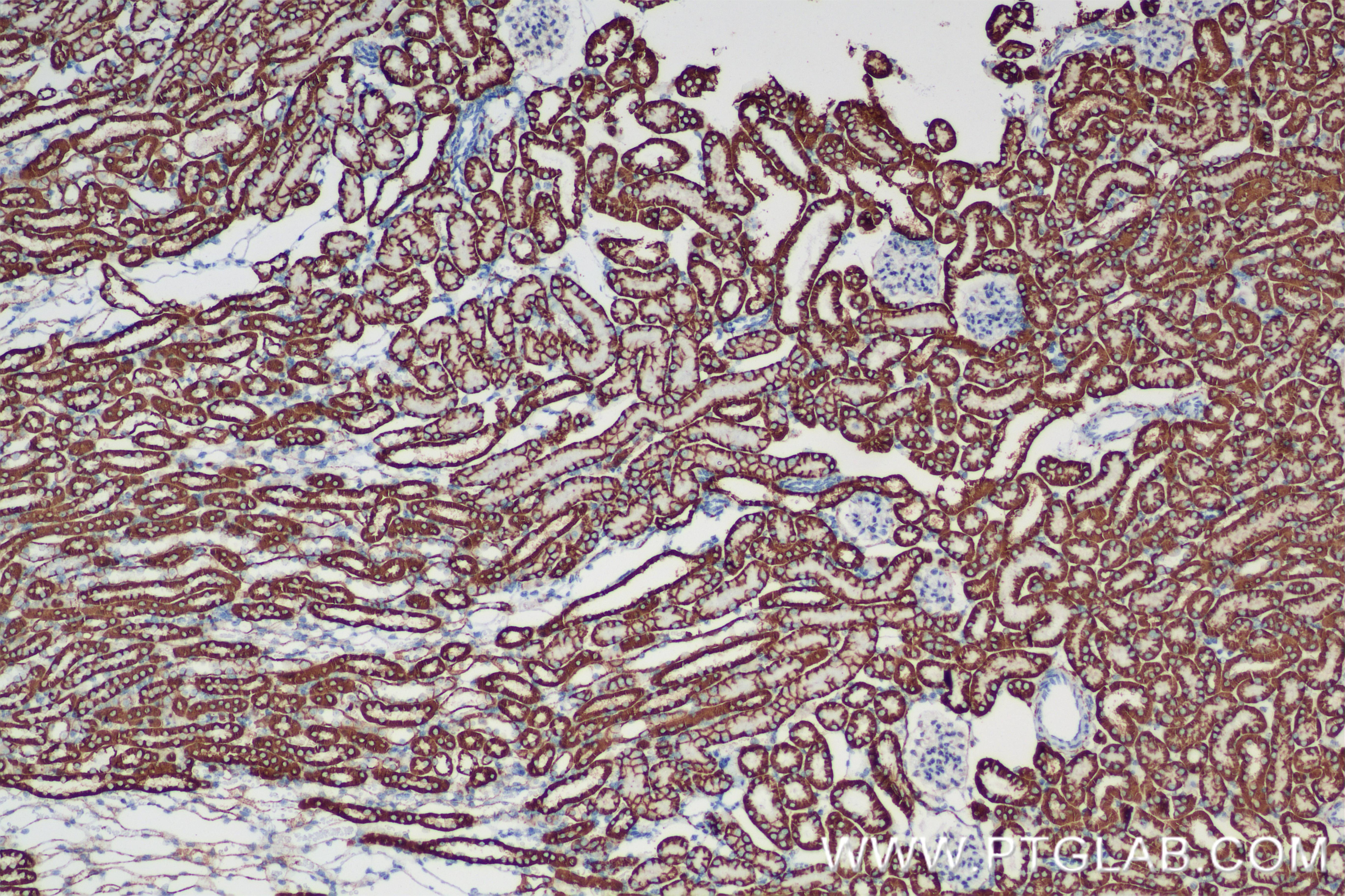 Immunohistochemistry (IHC) staining of mouse kidney tissue using ATP1B1 Recombinant antibody (84707-5-RR)