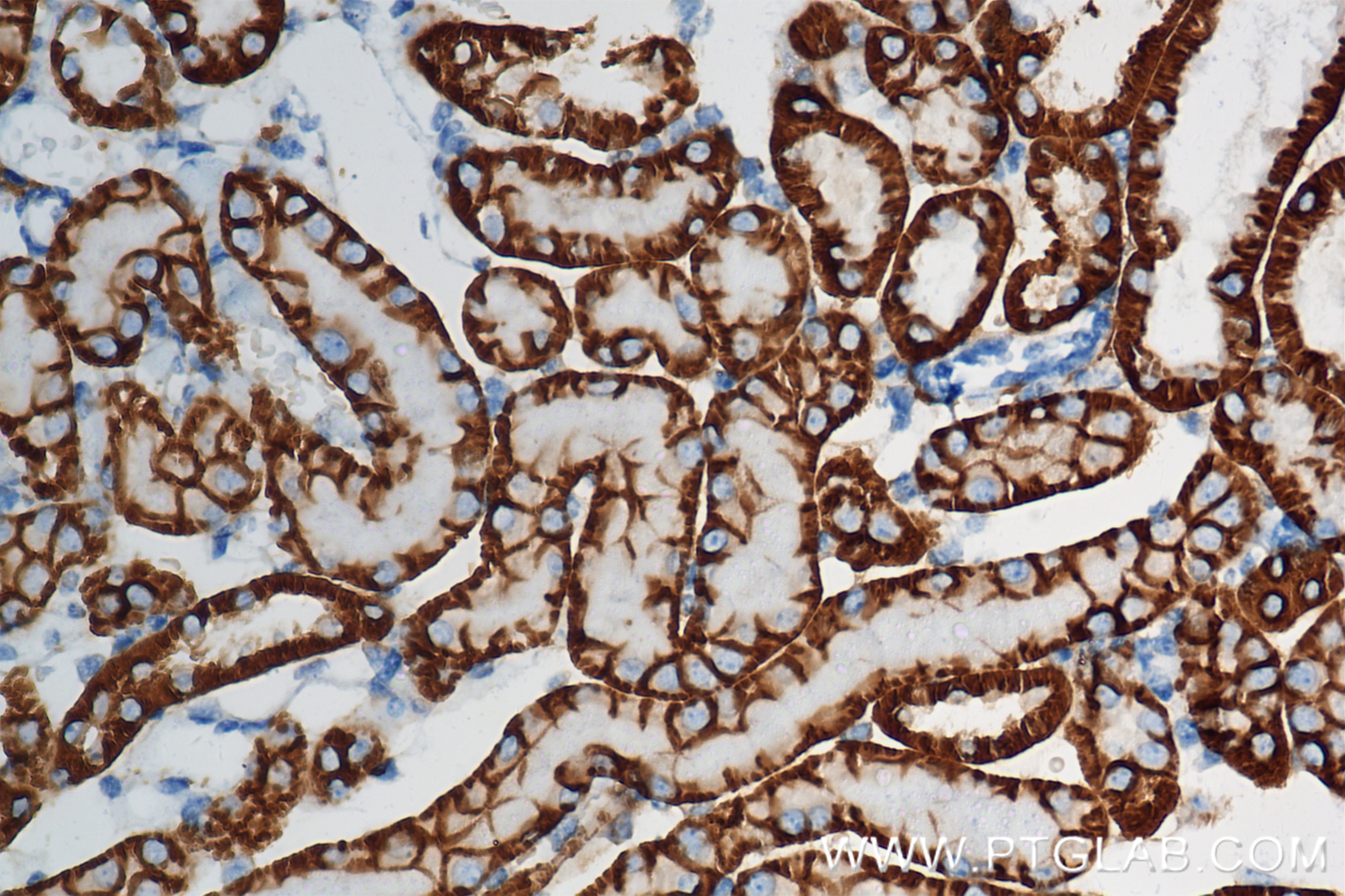 Immunohistochemistry (IHC) staining of mouse kidney tissue using ATP1B1 Recombinant antibody (84707-5-RR)