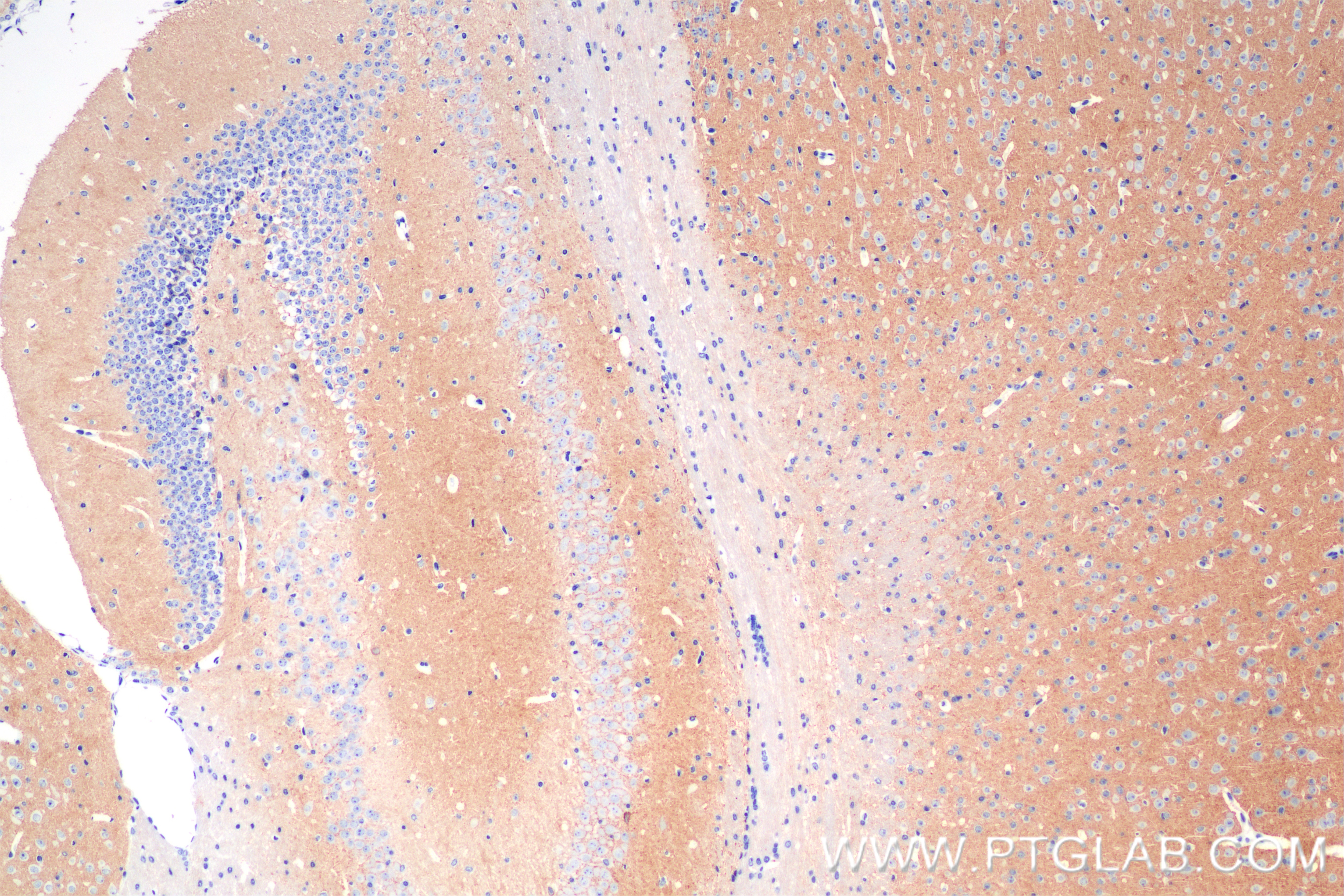 Immunohistochemistry (IHC) staining of mouse brain tissue using ATP1B1 Recombinant antibody (85916-1-RR)