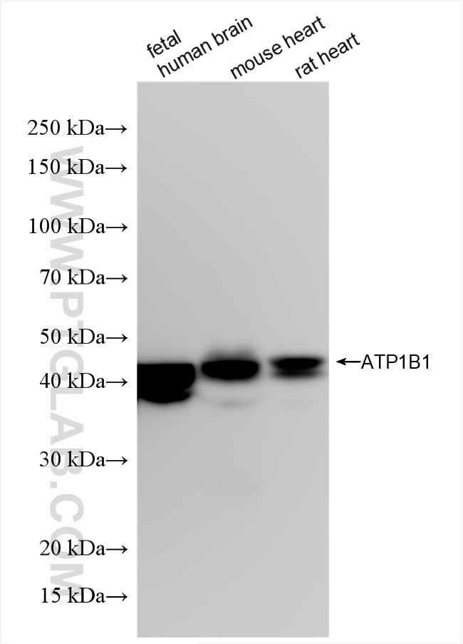Western Blot (WB) analysis of various lysates using ATP1B1 Recombinant antibody (85916-1-RR)