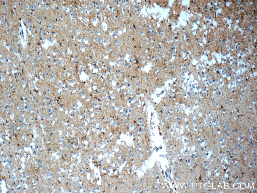 Immunohistochemistry (IHC) staining of human brain tissue using ATP1B2 Polyclonal antibody (22338-1-AP)