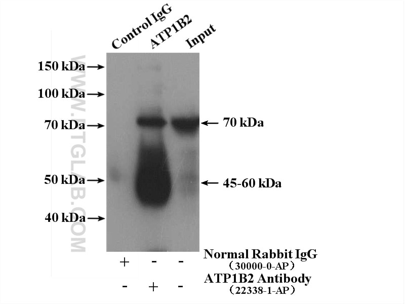 Immunoprecipitation (IP) experiment of mouse skeletal muscle tissue using ATP1B2 Polyclonal antibody (22338-1-AP)