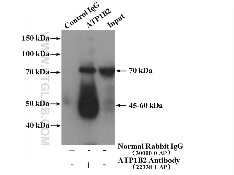 IP experiment of mouse skeletal muscle using 22338-1-AP