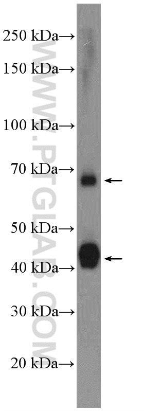 Western Blot (WB) analysis of mouse brain tissue using ATP1B2 Polyclonal antibody (22338-1-AP)