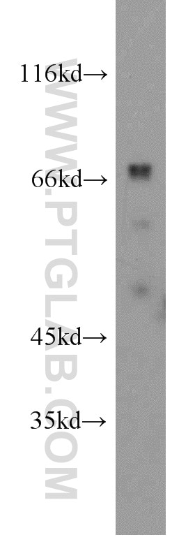 Western Blot (WB) analysis of human brain tissue using ATP1B2 Polyclonal antibody (22338-1-AP)