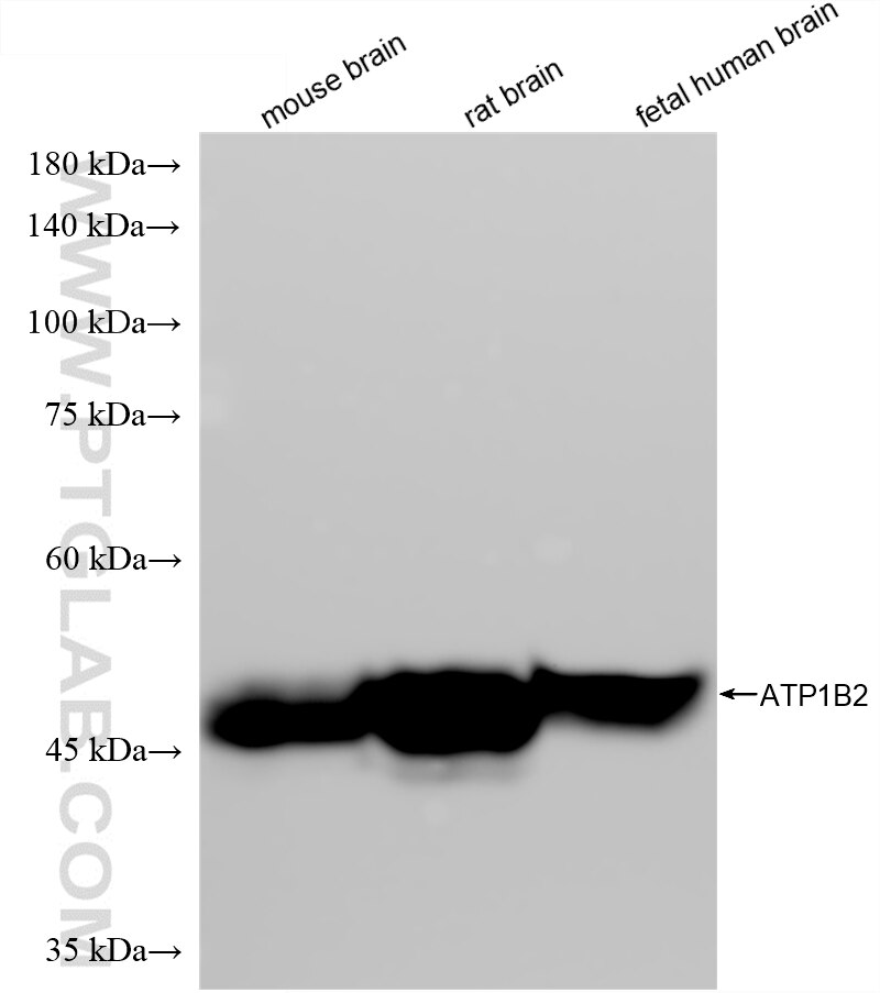 WB analysis using 88109-1-RR (same clone as 88109-1-PBS) Western Blot (WB) analysis of various lysates using ATP1B2 Recombinant monoclonal antibody (88109-1-RR)
