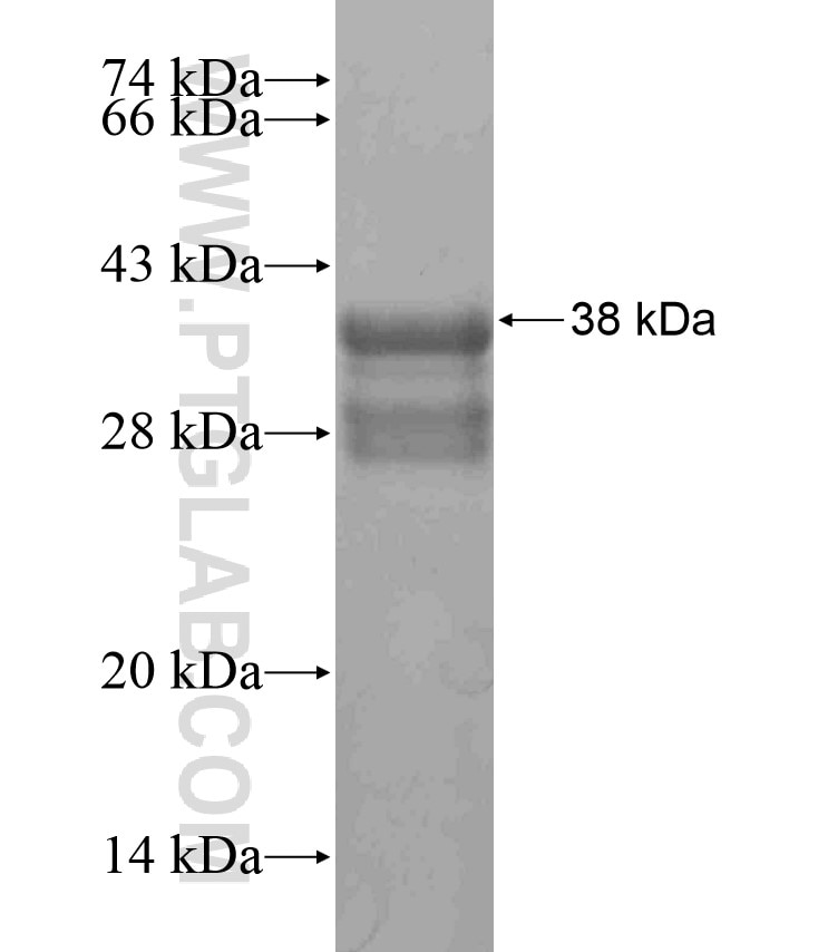 ATP1B2 fusion protein Ag17818 SDS-PAGE
