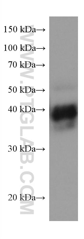 Western Blot (WB) analysis of human placenta tissue using ATP1B3 Monoclonal antibody (67554-1-Ig)