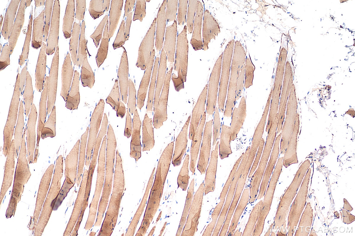 Immunohistochemistry (IHC) staining of mouse skeletal muscle tissue using ATP2A1 Polyclonal antibody (22361-1-AP)