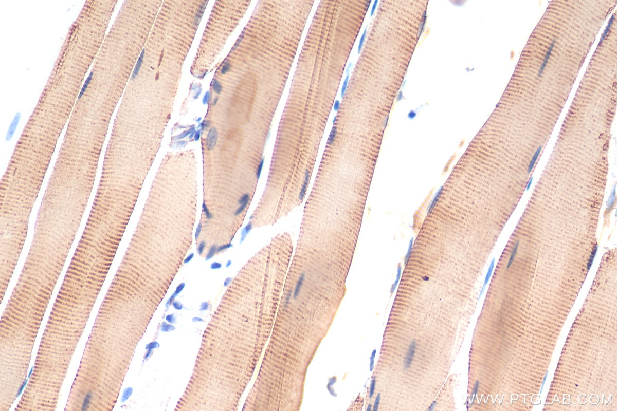 Immunohistochemistry (IHC) staining of mouse skeletal muscle tissue using ATP2A1 Polyclonal antibody (22361-1-AP)