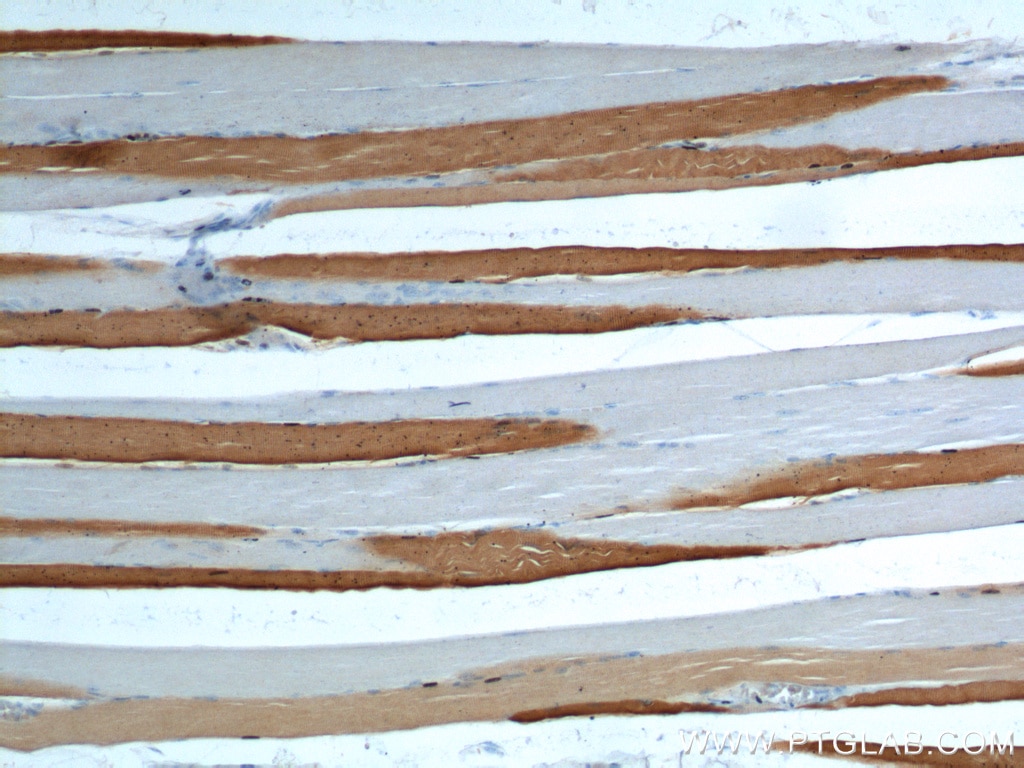 Immunohistochemistry (IHC) staining of human skeletal muscle tissue using ATP2A1 Polyclonal antibody (22361-1-AP)