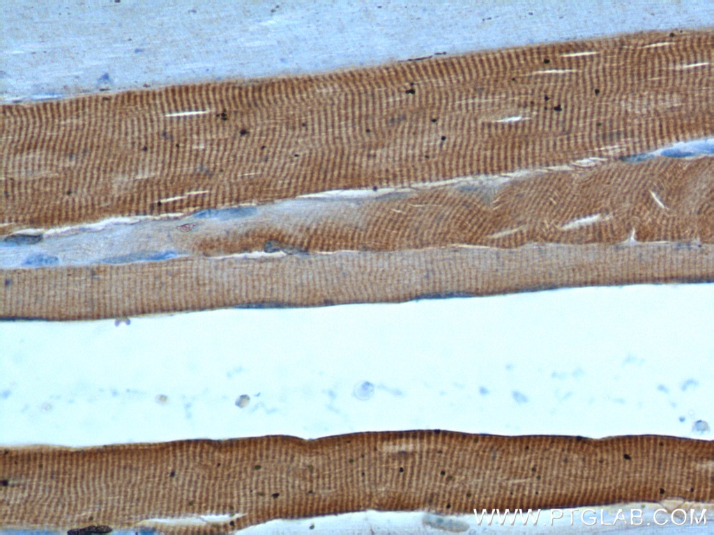 Immunohistochemistry (IHC) staining of human skeletal muscle tissue using ATP2A1 Polyclonal antibody (22361-1-AP)