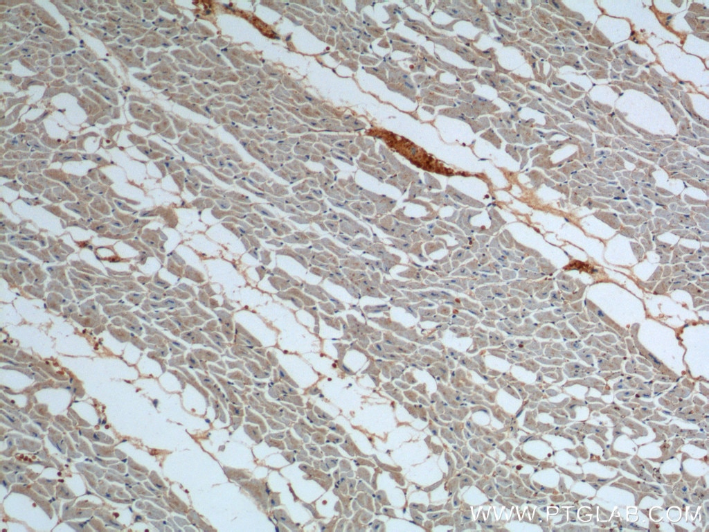 Immunohistochemistry (IHC) staining of human heart tissue using ATP2A1 Polyclonal antibody (22361-1-AP)