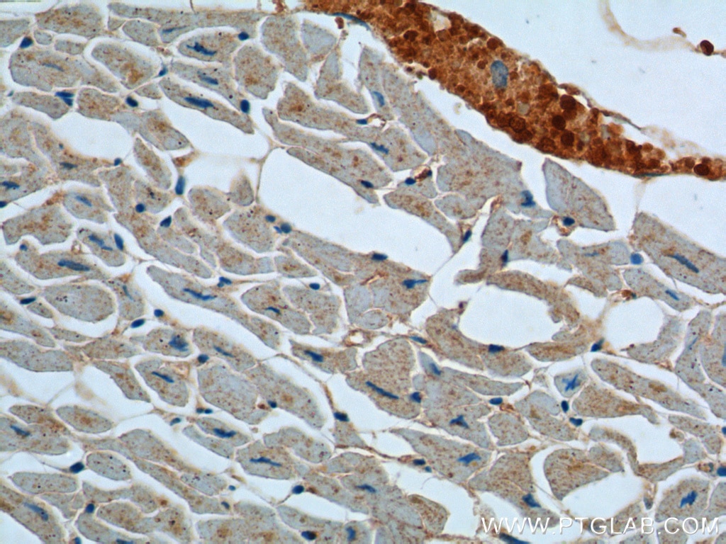 Immunohistochemistry (IHC) staining of human heart tissue using ATP2A1 Polyclonal antibody (22361-1-AP)