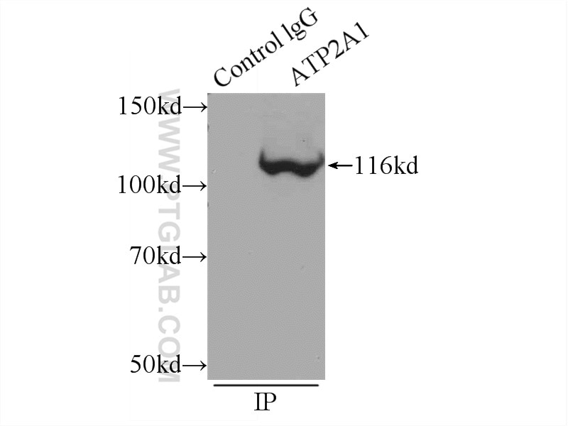 Immunoprecipitation (IP) experiment of mouse skeletal muscle tissue using ATP2A1 Polyclonal antibody (22361-1-AP)