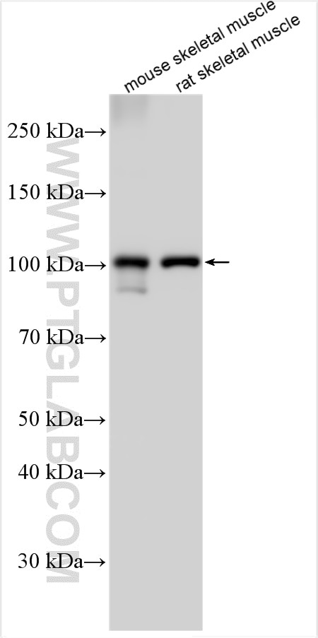 Western Blot (WB) analysis of various lysates using ATP2A1 Polyclonal antibody (22361-1-AP)