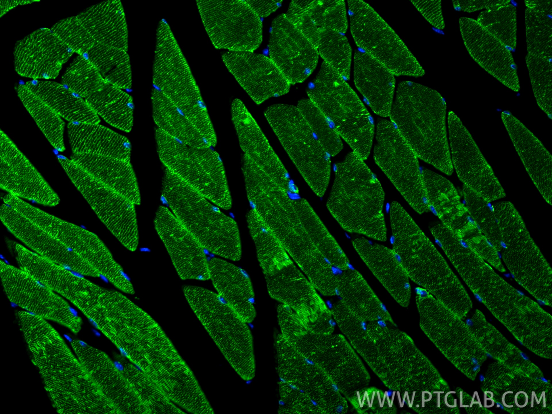 Immunofluorescent analysis of (4% PFA) fixed paraffin-embedded mouse skeletal muscle tissue using ATP2A1 antibody (84213-5-RR, Clone: 241500D12 ) at dilution of 1:400 and CoraLite®488-Conjugated Goat Anti-Rabbit IgG(H+L) (SA00013-2). Heat mediated antigen retrieval with Tris-EDTA buffer (pH 9.0). Immunofluorescence (IF) / fluorescent staining of mouse skeletal muscle tissue using ATP2A1 Recombinant monoclonal antibody (84213-5-RR)