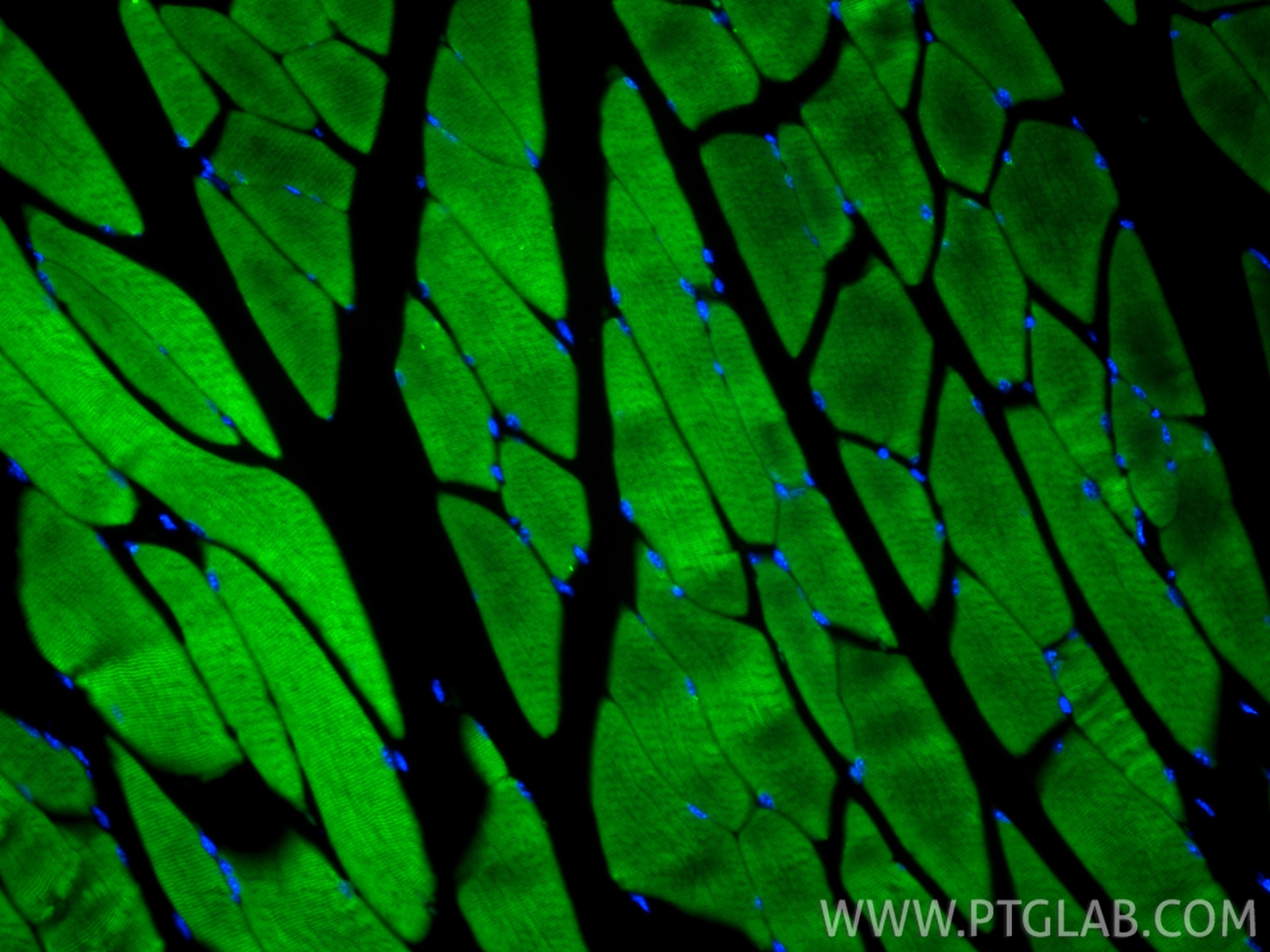 Immunofluorescent analysis of (4% PFA) fixed paraffin-embedded mouse skeletal muscle tissue using CoraLite® Plus 488 ATP2A1 antibody (CL488-84213-5, Clone: 241500D12 ) at dilution of 1:200. Heat mediated antigen retrieval with Tris-EDTA buffer (pH 9.0). Immunofluorescence (IF) / fluorescent staining of mouse skeletal muscle tissue using CoraLite® Plus 488-conjugated ATP2A1 Recombinant m (CL488-84213-5)