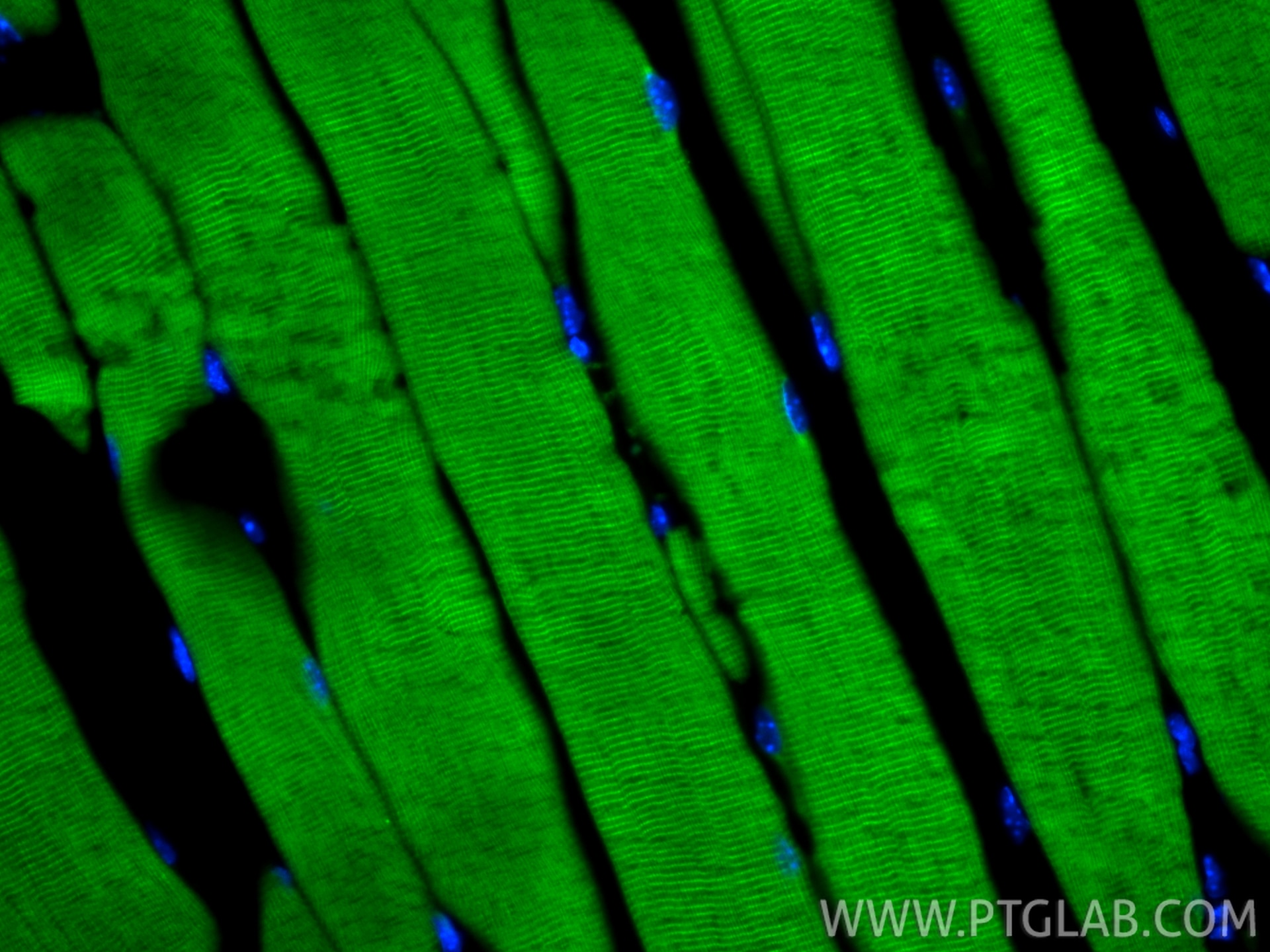 Immunofluorescent analysis of (4% PFA) fixed paraffin-embedded mouse skeletal muscle tissue using CoraLite® Plus 488 ATP2A1 antibody (CL488-84213-5, Clone: 241500D12 ) at dilution of 1:200. Heat mediated antigen retrieval with Tris-EDTA buffer (pH 9.0). Immunofluorescence (IF) / fluorescent staining of mouse skeletal muscle tissue using CoraLite® Plus 488-conjugated ATP2A1 Recombinant m (CL488-84213-5)